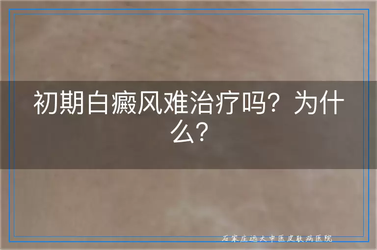初期白癜风难治疗吗？为什么？