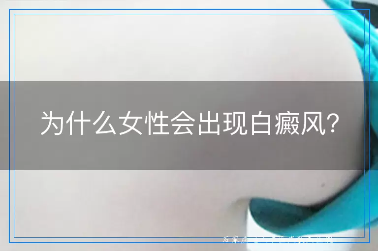 为什么女性会出现白癜风？