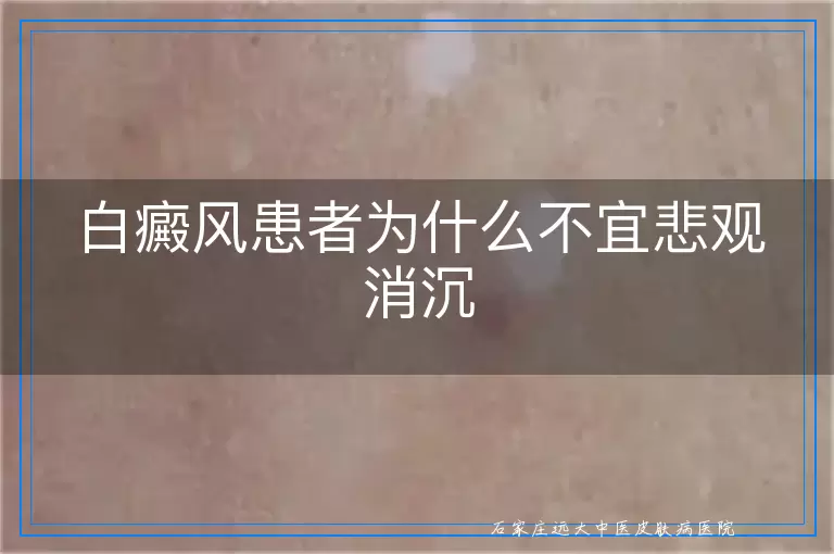 白癜风患者为什么不宜悲观消沉
