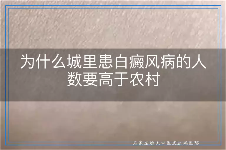 为什么城里患白癜风病的人数要高于农村