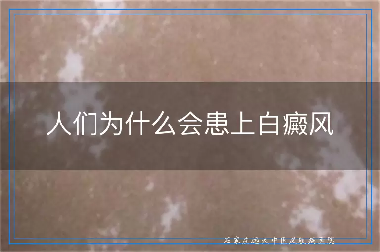 人们为什么会患上白癜风