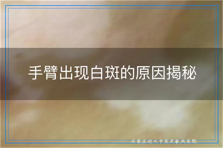 手臂出现白斑的原因揭秘