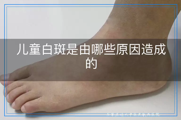 儿童白斑是由哪些原因造成的