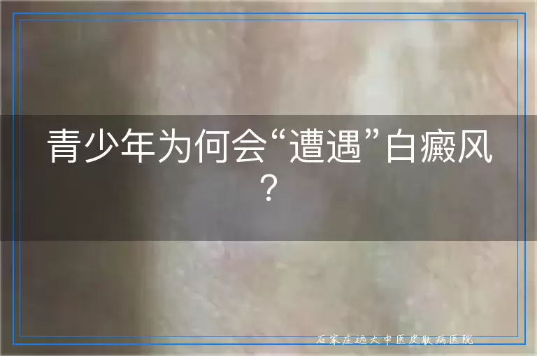 青少年为何会“遭遇”白癜风？