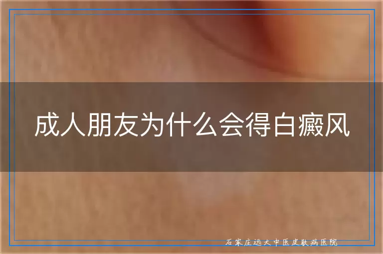 成人朋友为什么会得白癜风