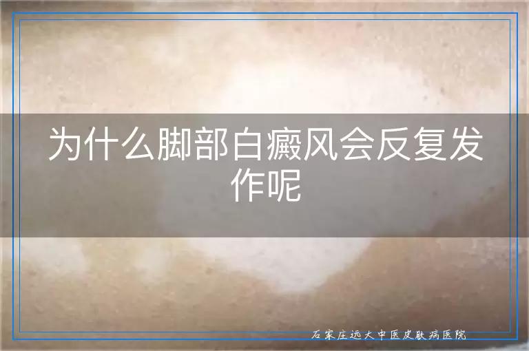 为什么脚部白癜风会反复发作呢