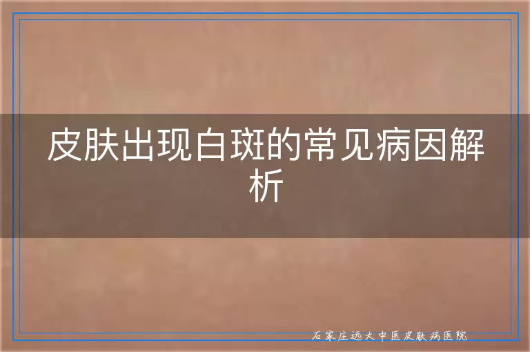 皮肤出现白斑的常见病因解析