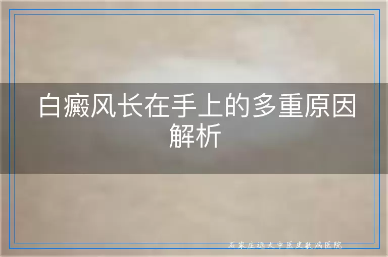 白癜风长在手上的多重原因解析