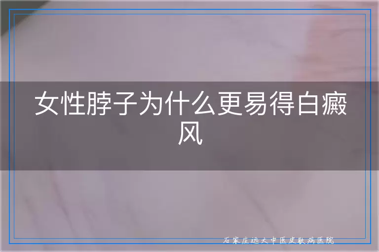 女性脖子为什么更易得白癜风