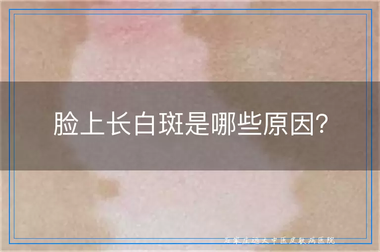 脸上长白斑是哪些原因？