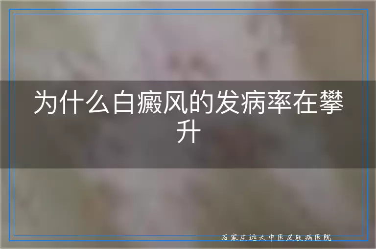 为什么白癜风的发病率在攀升
