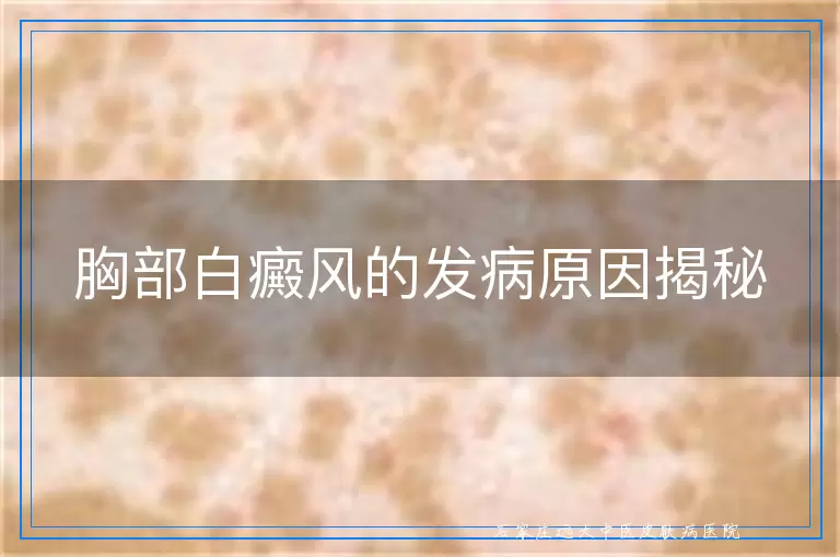 胸部白癜风的发病原因揭秘