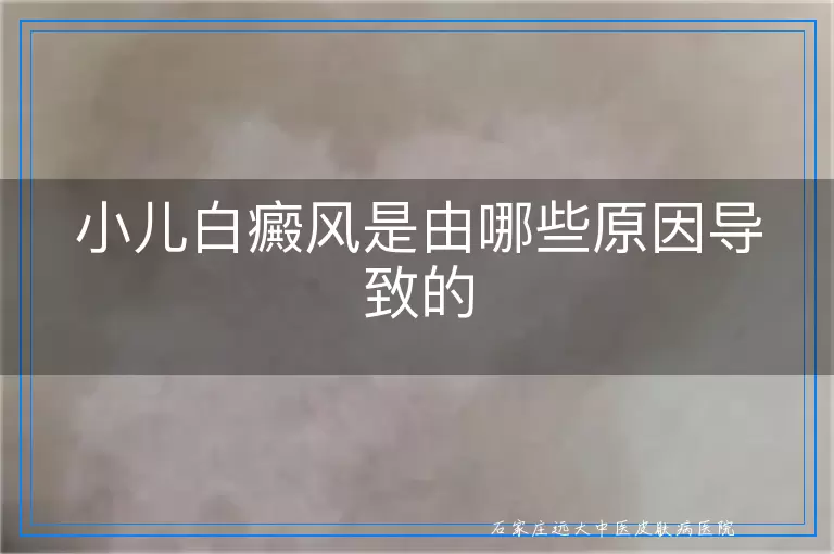 小儿白癜风是由哪些原因导致的