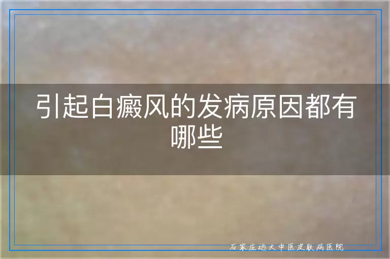 引起白癜风的发病原因都有哪些