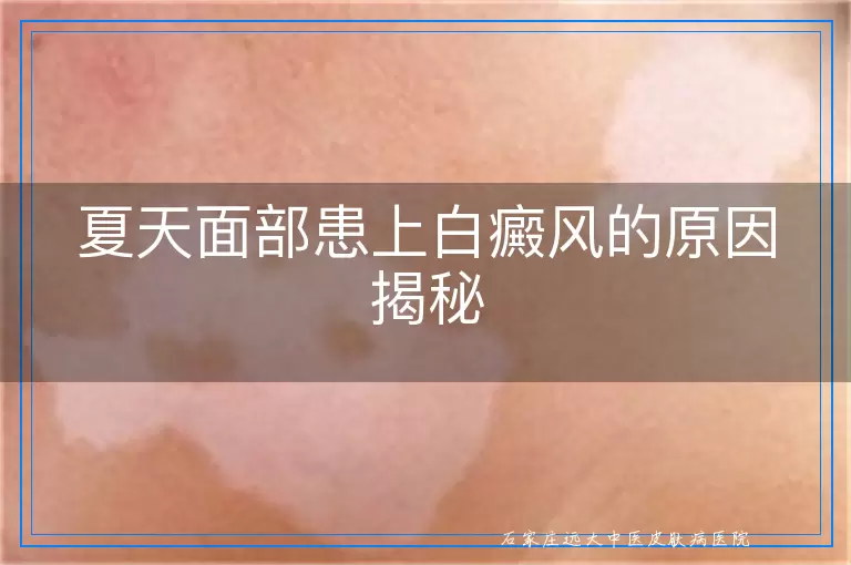 夏天面部患上白癜风的原因揭秘