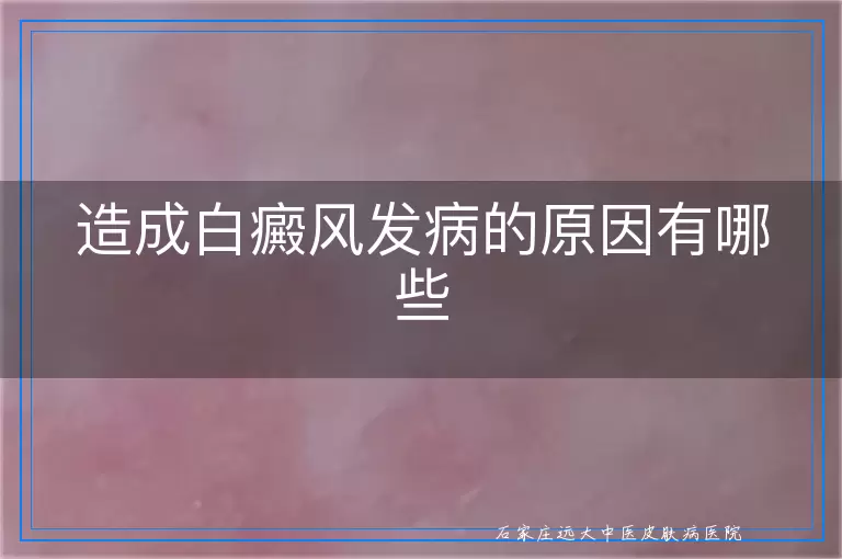 造成白癜风发病的原因有哪些
