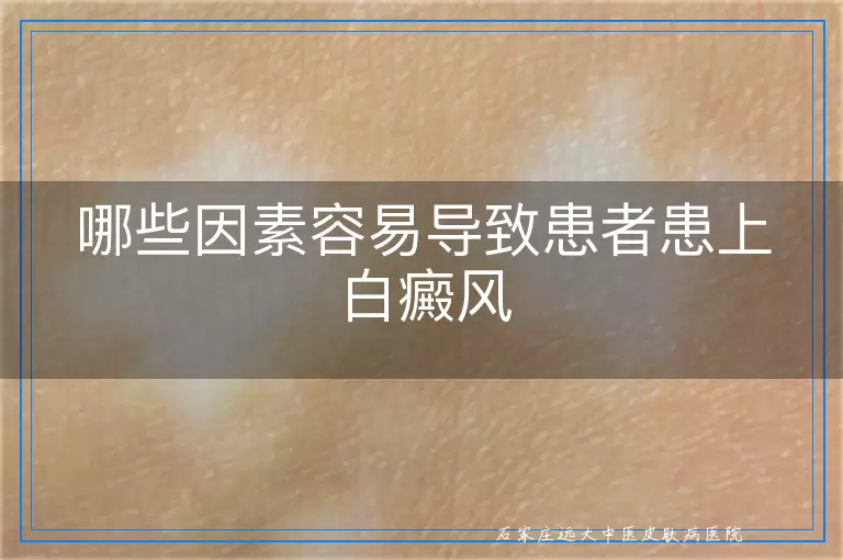 哪些因素容易导致患者患上白癜风
