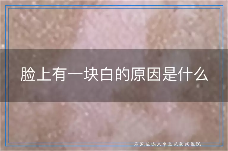 脸上有一块白的原因是什么