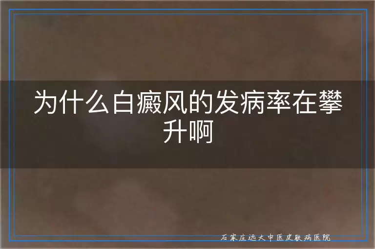为什么白癜风的发病率在攀升啊