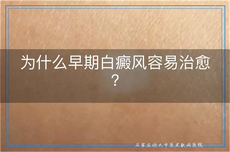 为什么早期白癜风容易治愈？