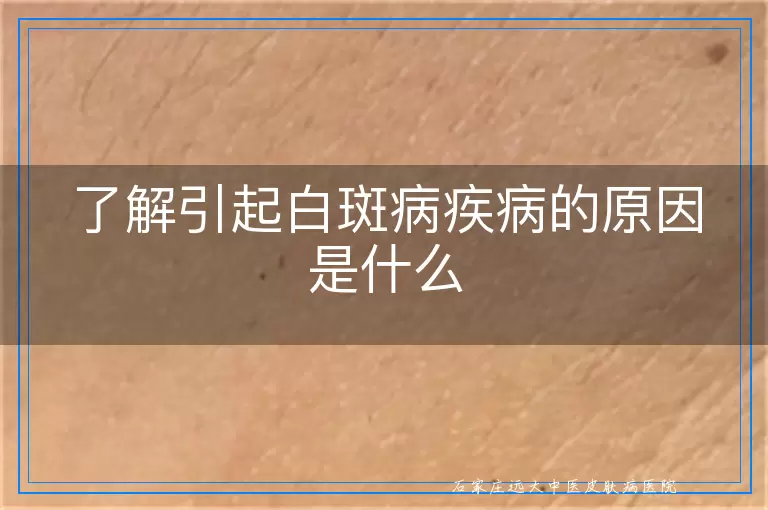 了解引起白斑病疾病的原因是什么