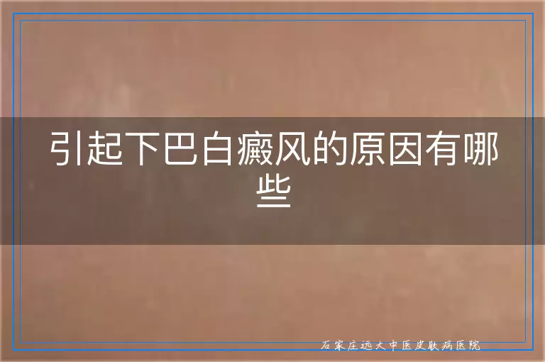 引起下巴白癜风的原因有哪些