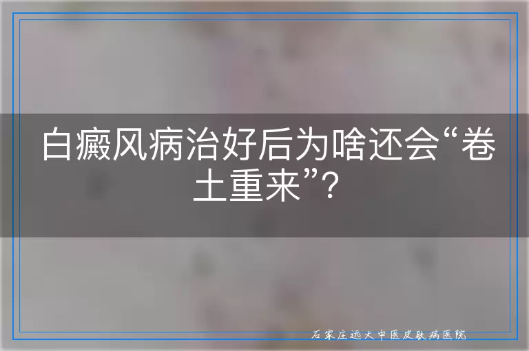 白癜风病治好后为啥还会“卷土重来”？
