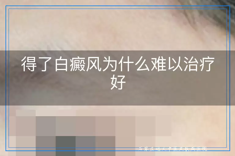 得了白癜风为什么难以治疗好