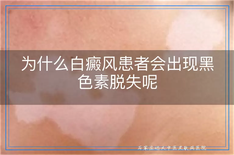 为什么白癜风患者会出现黑色素脱失呢