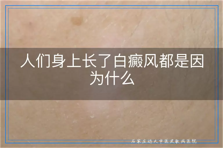 人们身上长了白癜风都是因为什么