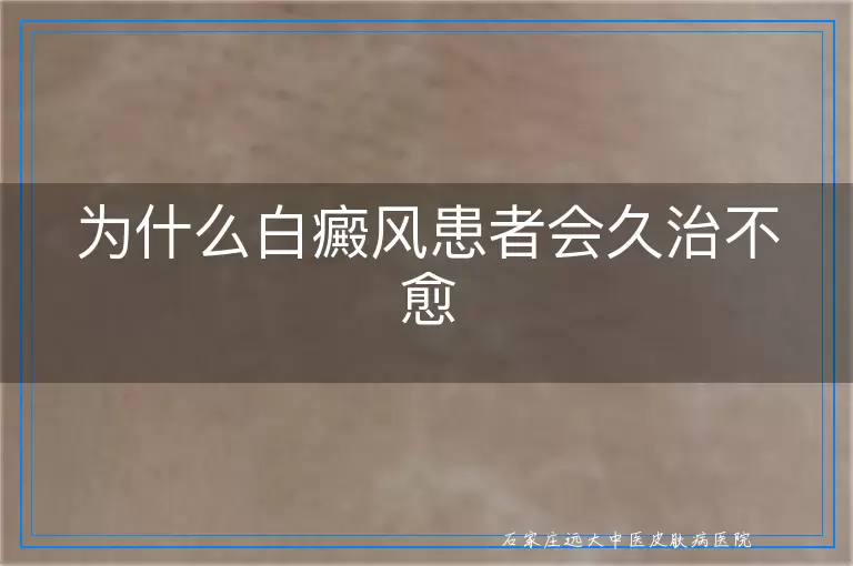 为什么白癜风患者会久治不愈