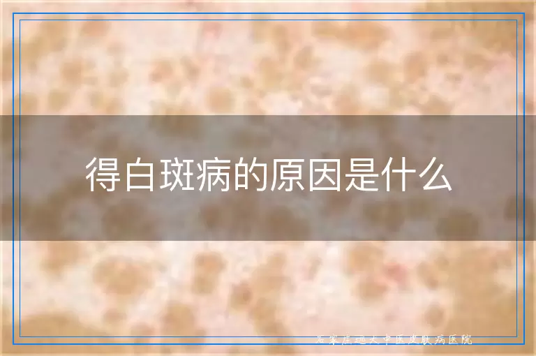 得白斑病的原因是什么