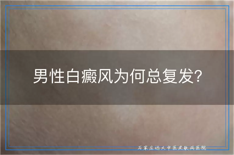男性白癜风为何总复发？