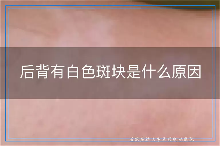后背有白色斑块是什么原因