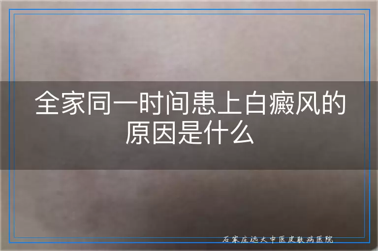 全家同一时间患上白癜风的原因是什么