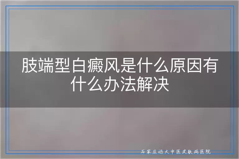 肢端型白癜风是什么原因有什么办法解决