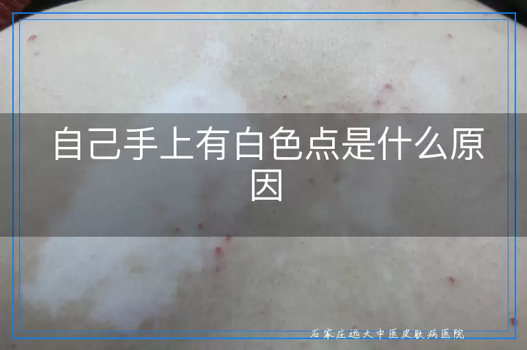 自己手上有白色点是什么原因