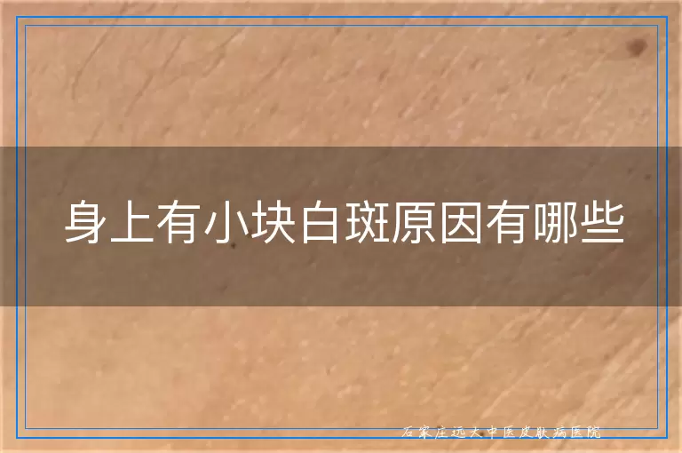 身上有小块白斑原因有哪些
