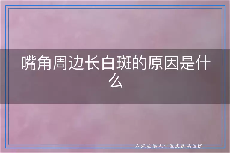 嘴角周边长白斑的原因是什么