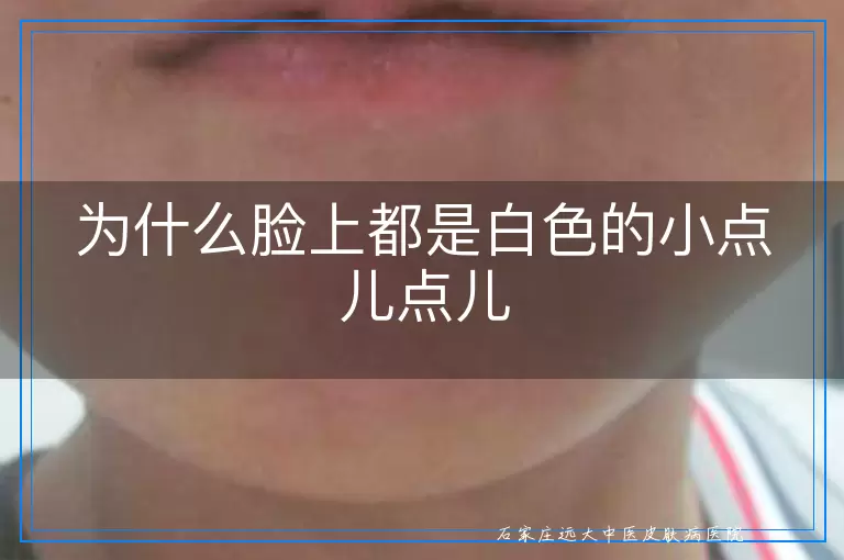 为什么脸上都是白色的小点儿点儿