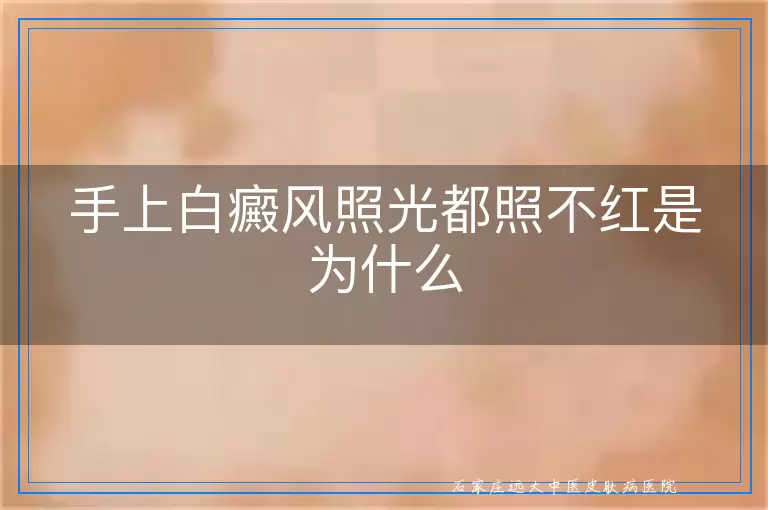 手上白癜风照光都照不红是为什么