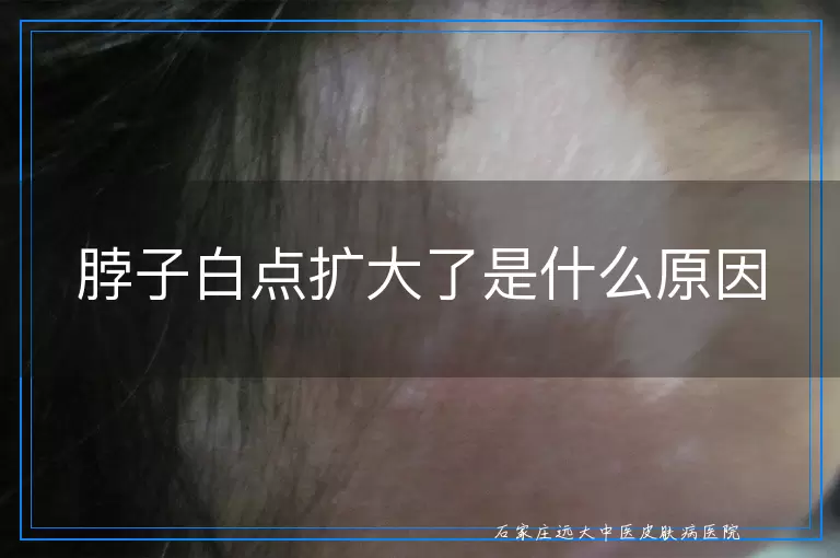 脖子白点扩大了是什么原因