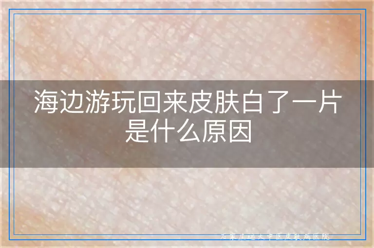 海边游玩回来皮肤白了一片是什么原因
