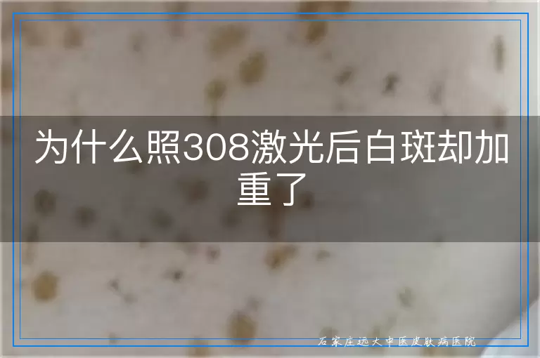 为什么照308激光后白斑却加重了