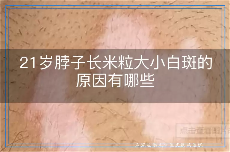 21岁脖子长米粒大小白斑的原因有哪些