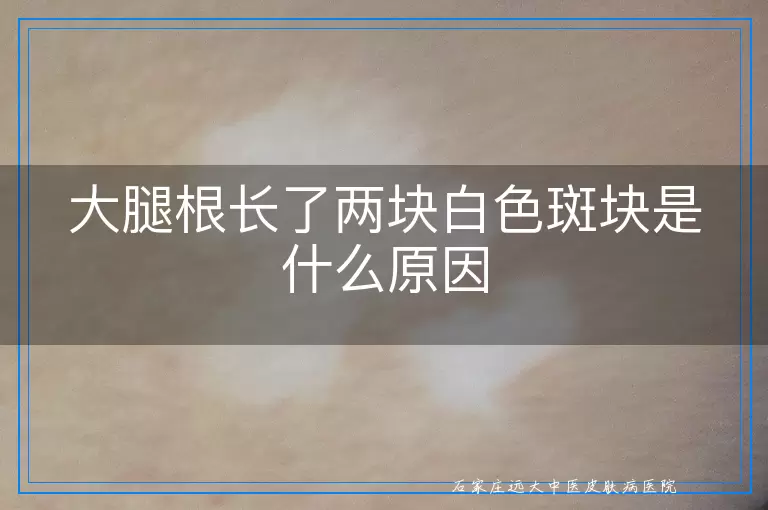 大腿根长了两块白色斑块是什么原因