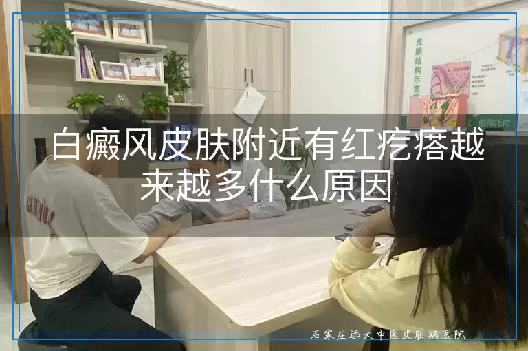 白癜风皮肤附近有红疙瘩越来越多什么原因