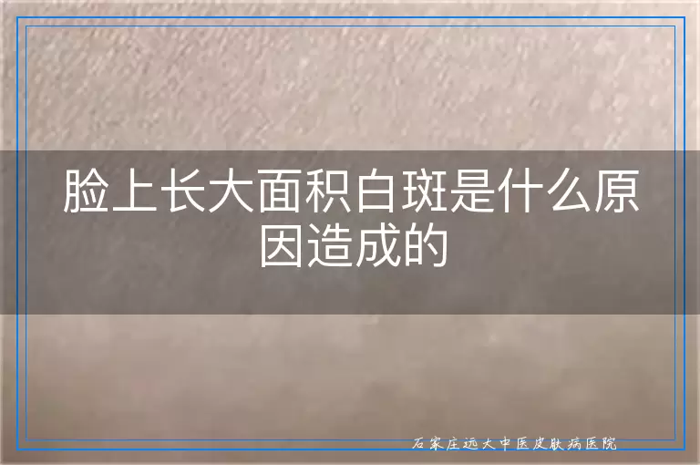 脸上长大面积白斑是什么原因造成的