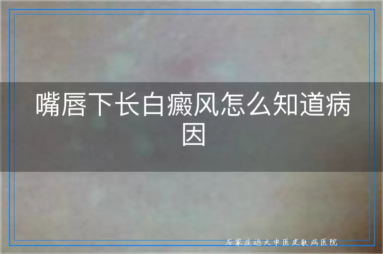嘴唇下长白癜风怎么知道病因
