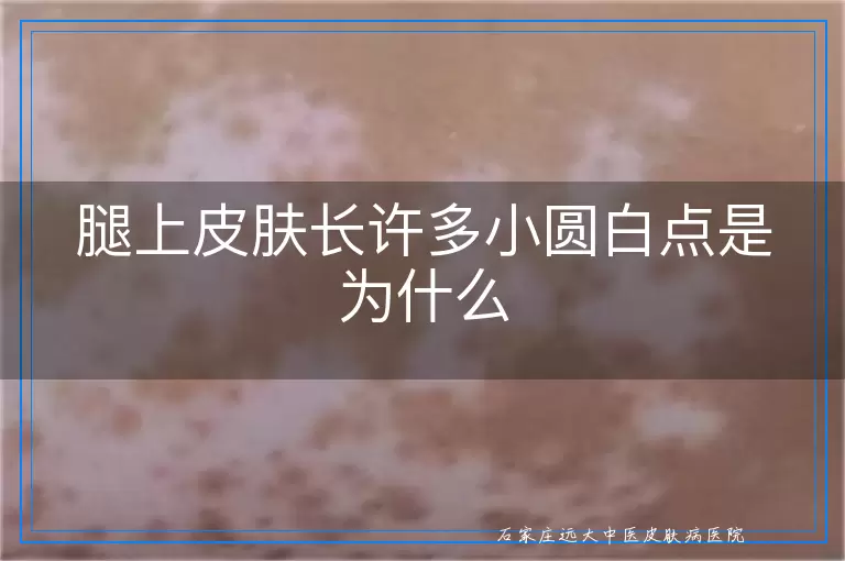 腿上皮肤长许多小圆白点是为什么